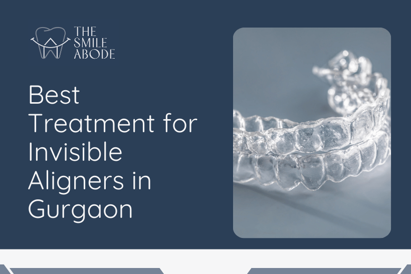 Treatment for Invisible Aligners