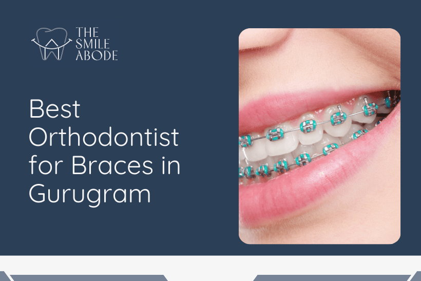 Braces Treatment in Gurugram