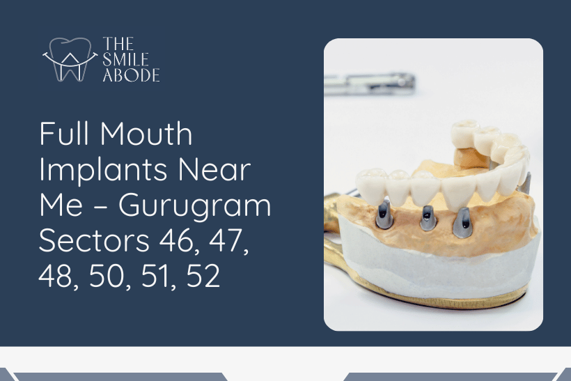 Full Mouth Implants