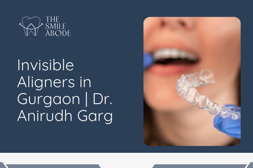 Invisible Aligners in Gurgaon