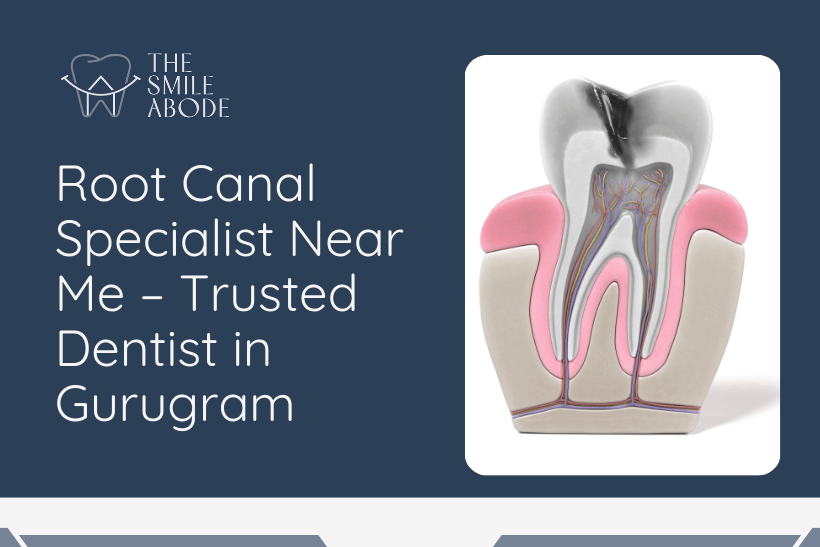 Root Canal Treatment