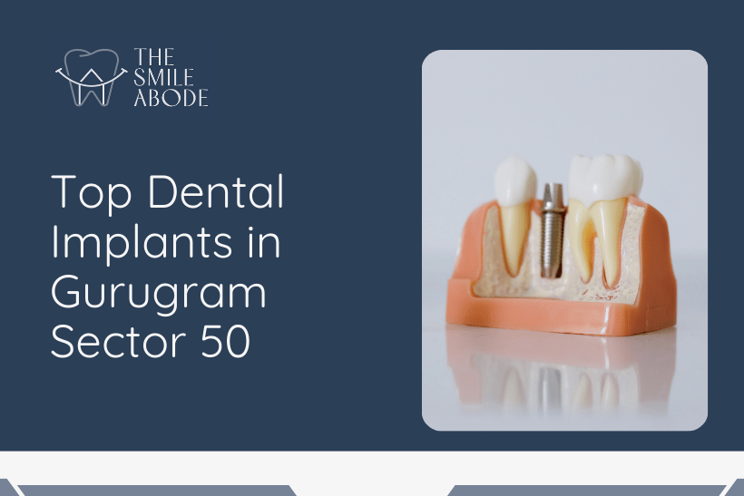 Dental Implants in Gurugram