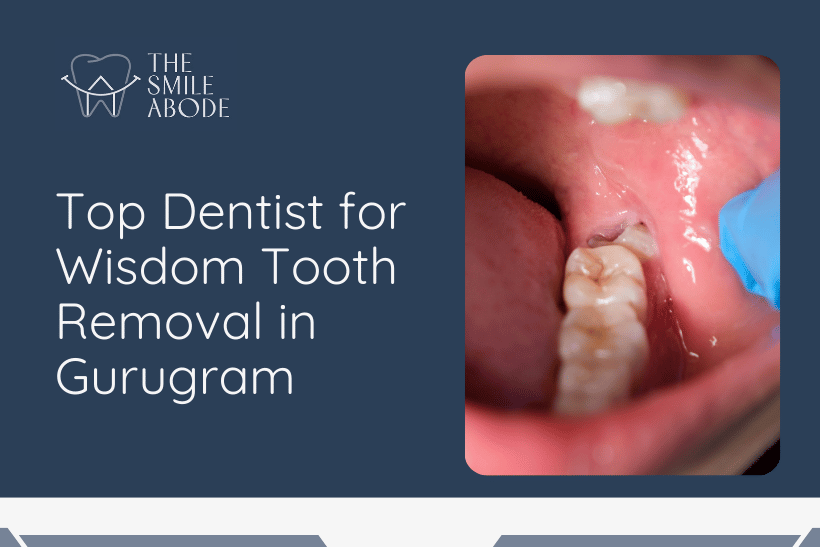 Wisdom Tooth Removal