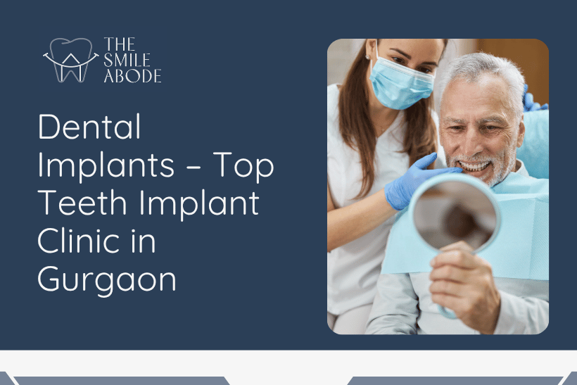 Dental Implants Clinic in Gurgaon