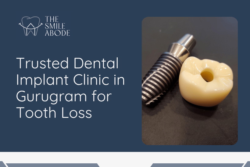 Dental Implant Clinic in Gurugram