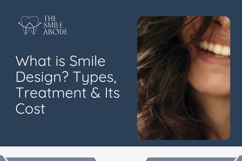 Best Smile Designing in Gurugram