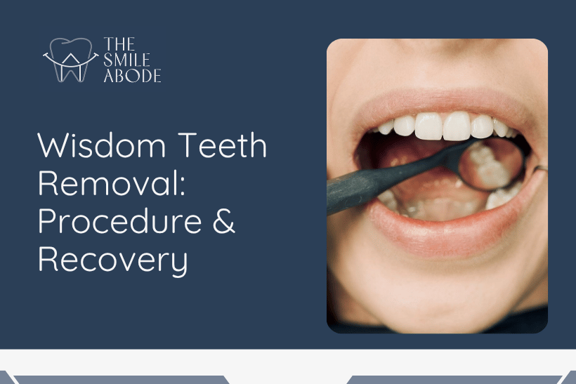Wisdom Teeth Removal