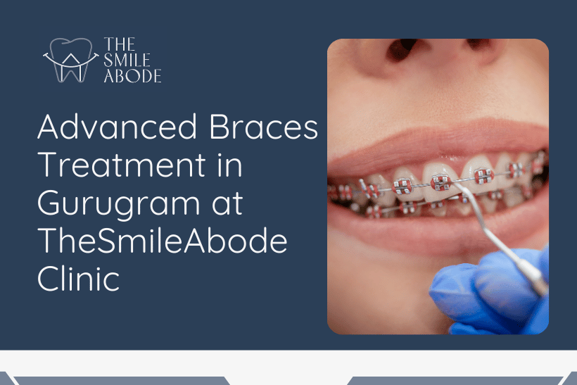 Best Braces Treatment In Gurugram