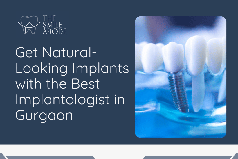 Best implantologist in Gurgaon