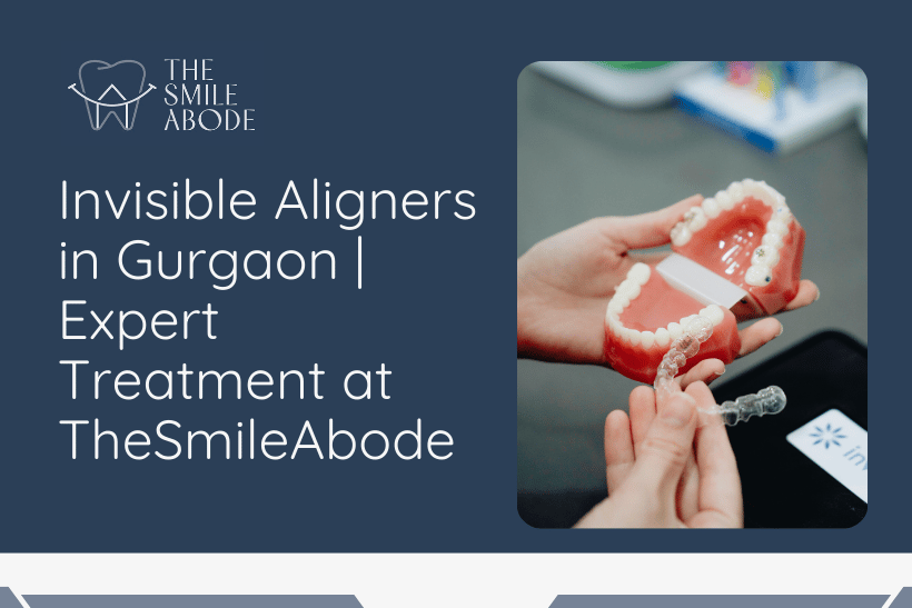 Best Treatment for Invisible Aligners in Gurgaon