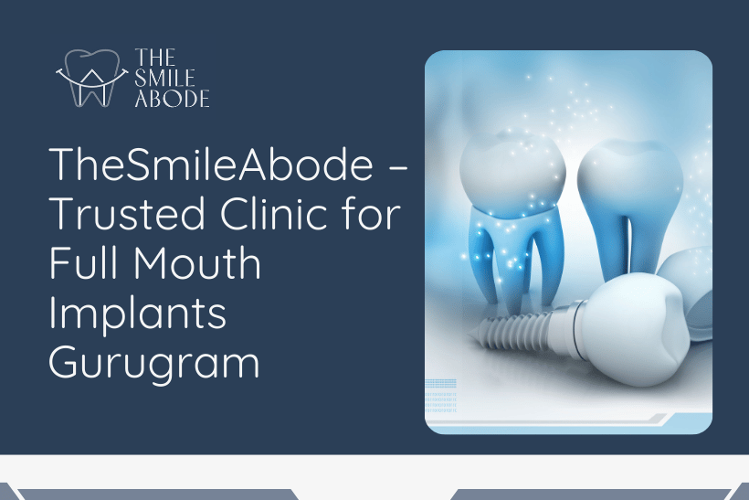 Best ⁠Full mouth implants in Gurugram