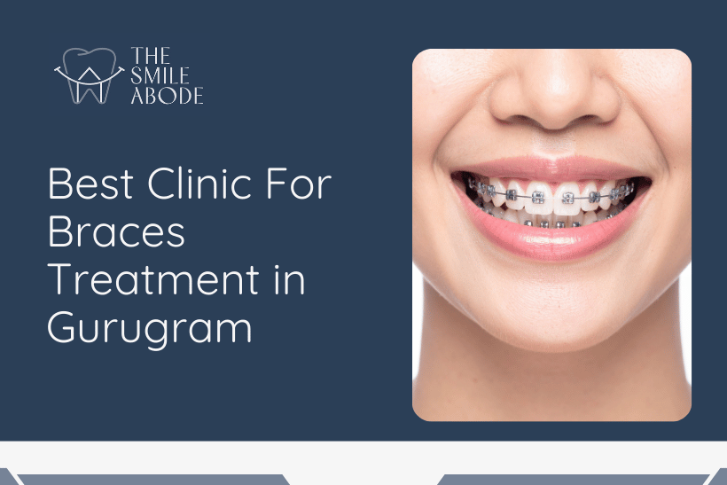 Best Braces Treatment in Gurugram