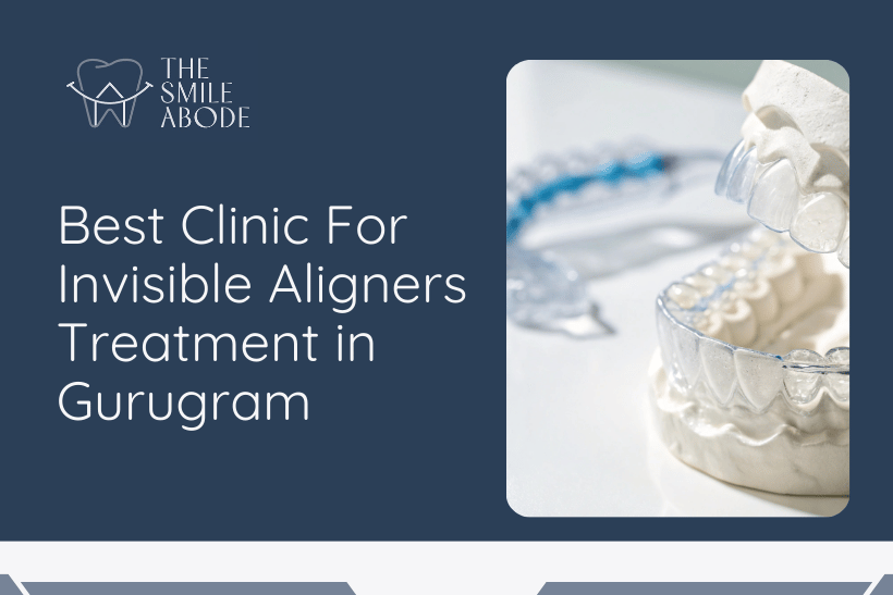 Treatment for Invisible Aligners in Gurgaon