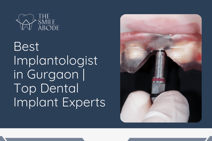 Best implantologist in Gurgaon
