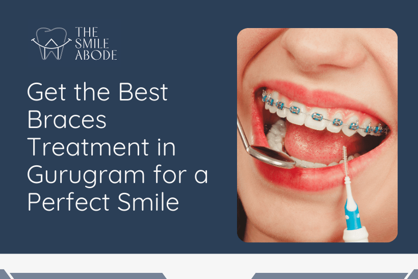 Braces Treatment in Gurugram
