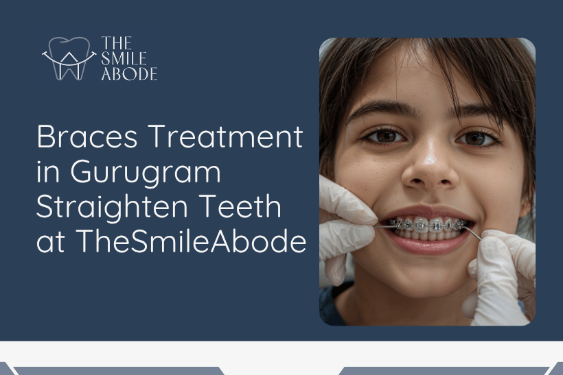 Braces Treatment in Gurugram