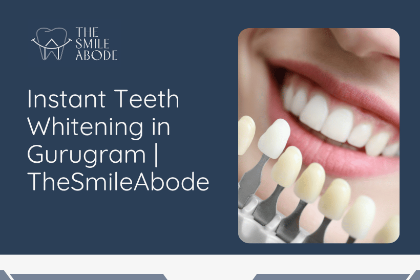 Teeth Whitening in Gurugram