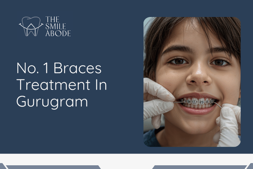 Braces Treatment In Gurugram