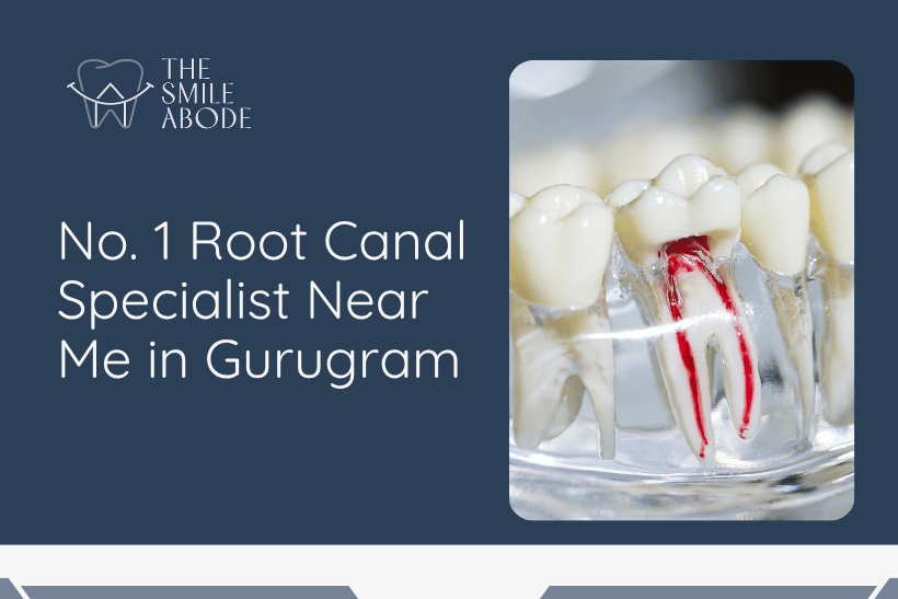 Root Canal Specialist
