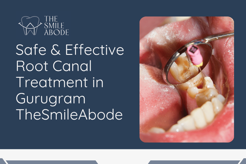 Root Canal Treatment in Gurugram