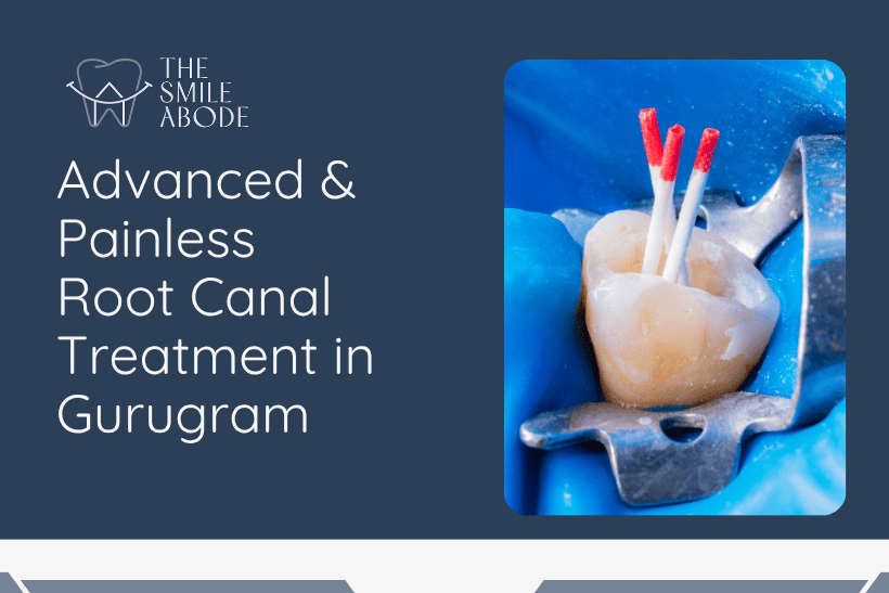 Painless Root Canal Treatment in Gurugram