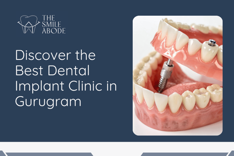 Dental Implant Clinic in Gurugram