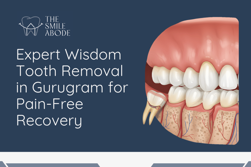 Best Wisdom Tooth Removal in Gurugram