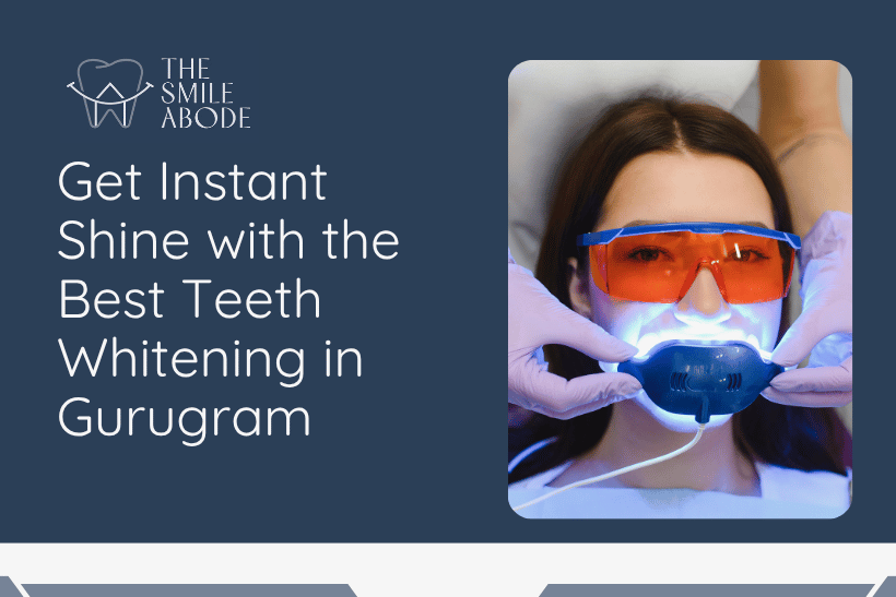 Best Teeth Whitening in Gurugram