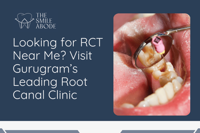 Root Canal Treatment (RCT)