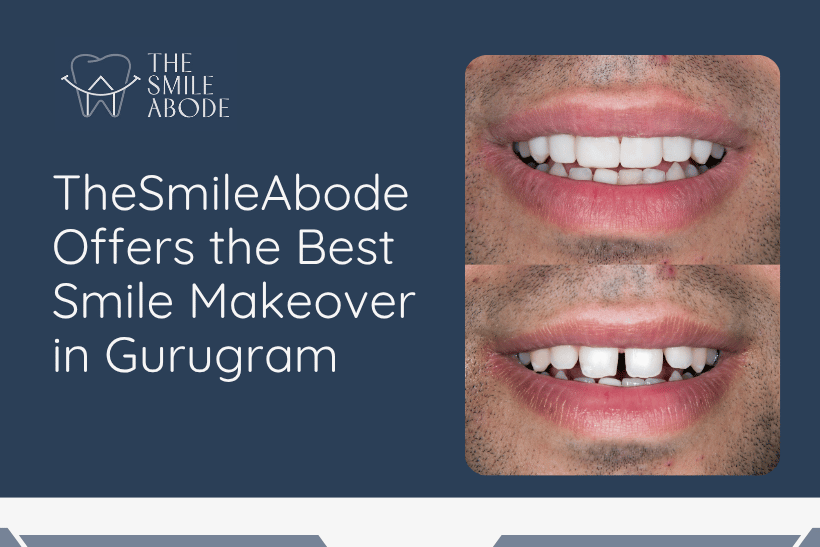 Smile Designing in Gurugram