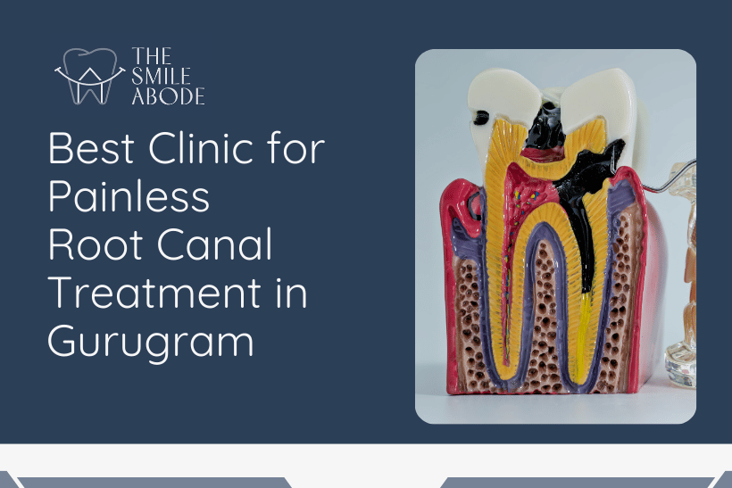 Best Painless Root Canal Treatment in Gurugram