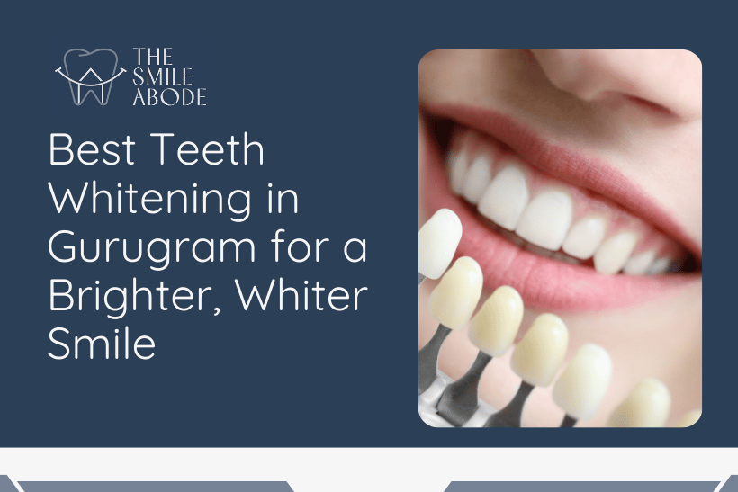 Best Teeth whitening in Gurugram