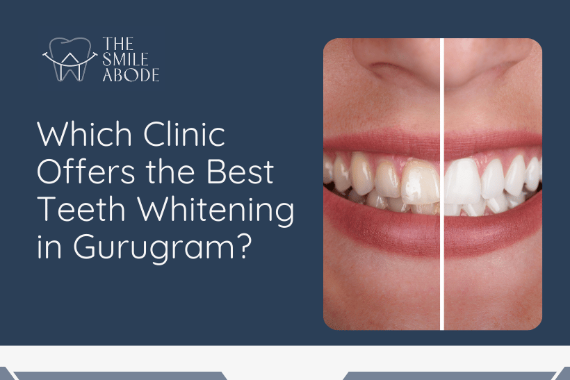 Teeth Whitening in Gurugram