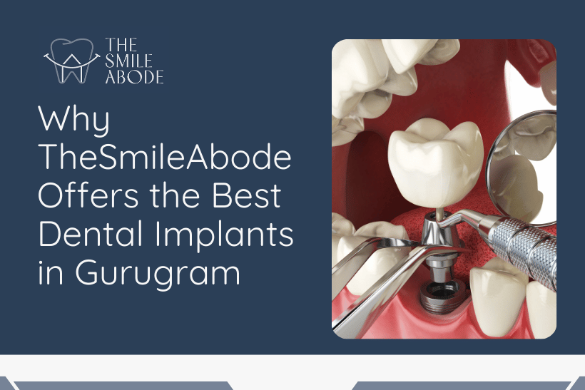 Best Dental Implants in Gurugram