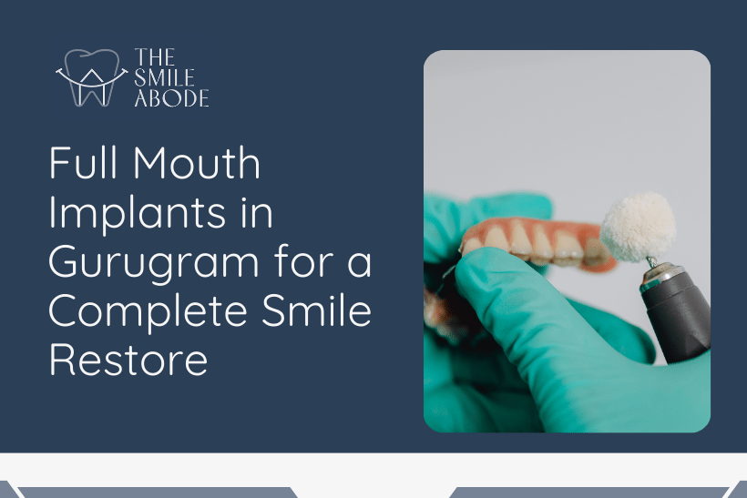 Full Mouth Implants in Gurugram