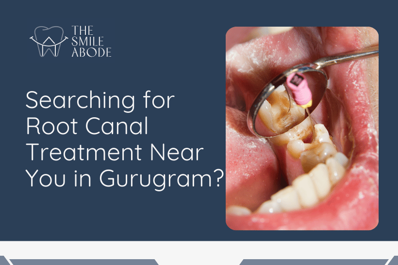 Best Root Canal Specialist Near me Gurugram