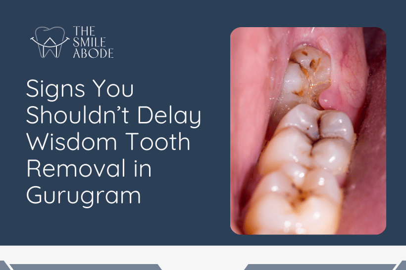 Best Wisdom Tooth Removal in Gurugram