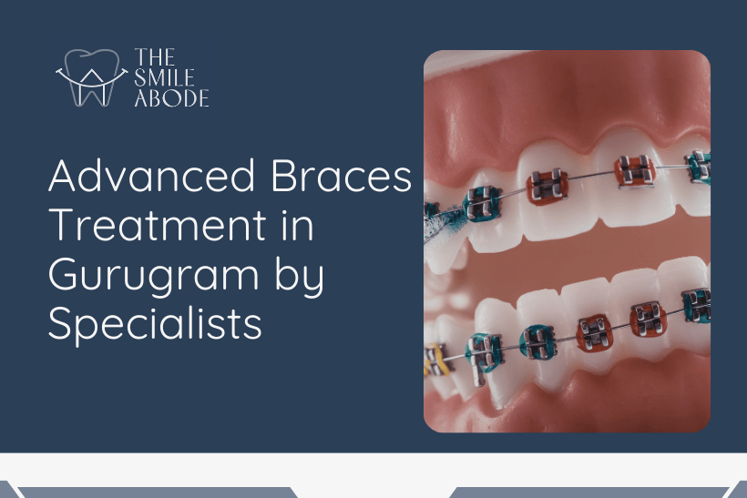 Best Braces Treatment in Gurugram