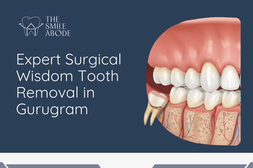 Best Wisdom Tooth Removal in Gurugram