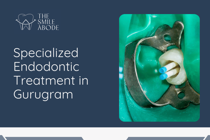 Top Root Canal Specialist Near Me in Gurugram