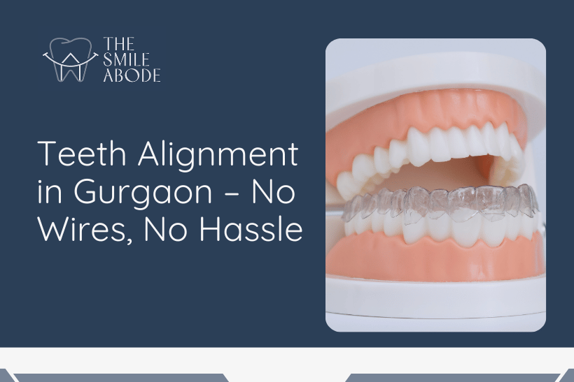 Best Treatment for Invisible Aligners in Gurgaon