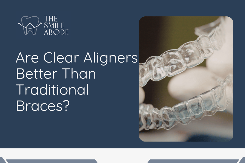 Treatment for Invisible Aligners in Gurgaon