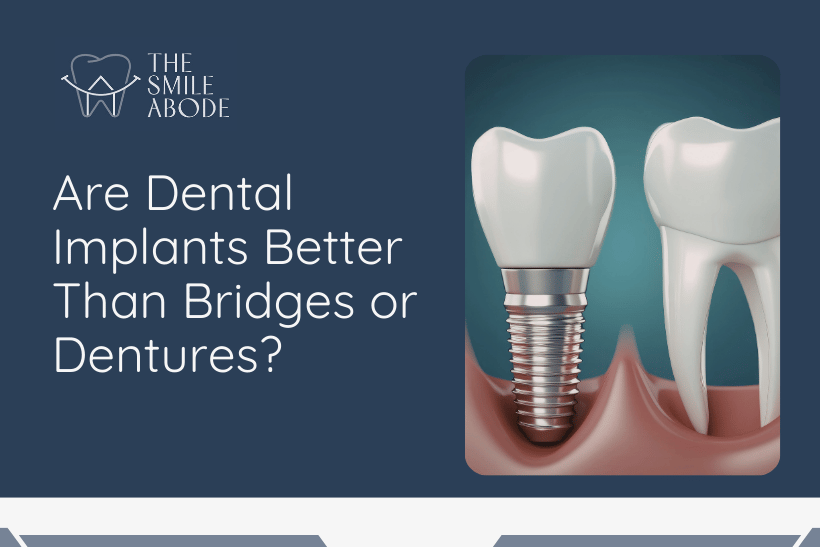 Dental Implants in Gurugram