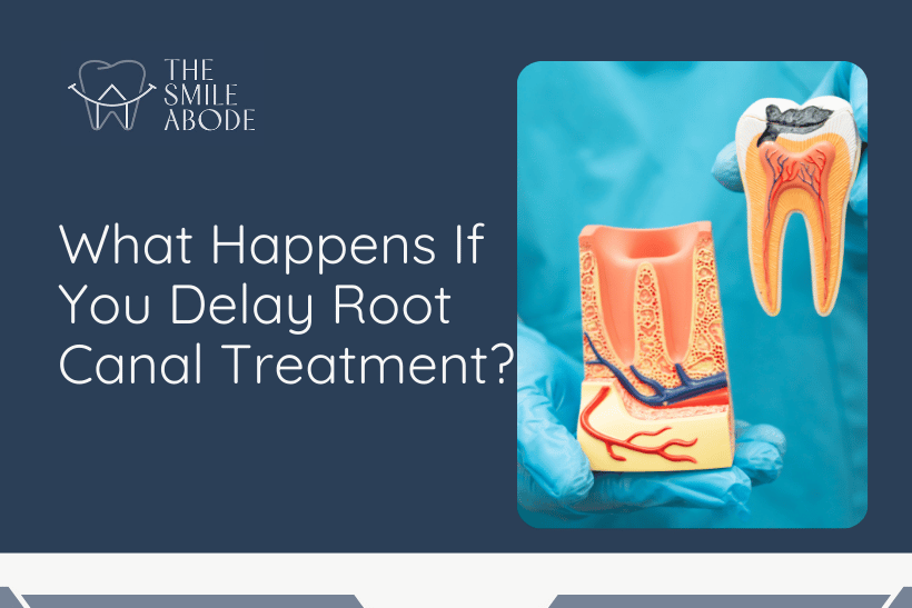 Painless Root Canal Treatment in Gurugram