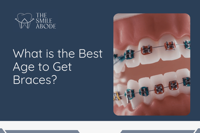 Best Braces Treatment in Gurugram