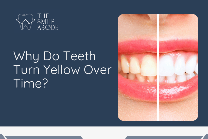 Best Teeth Whitening in Gurugram