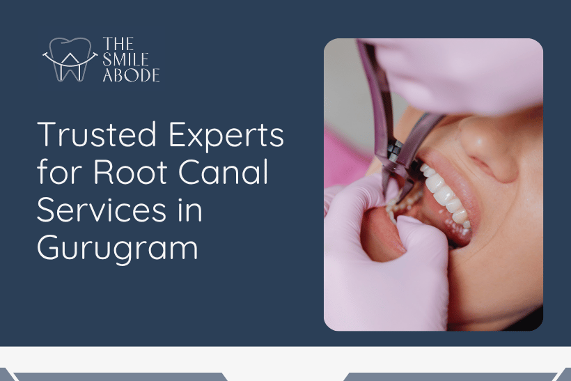 Root Canal Services in Gurugram