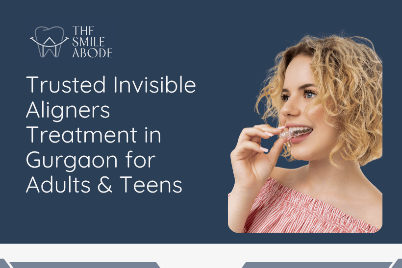 Invisible Aligners Treatment in Gurgaon