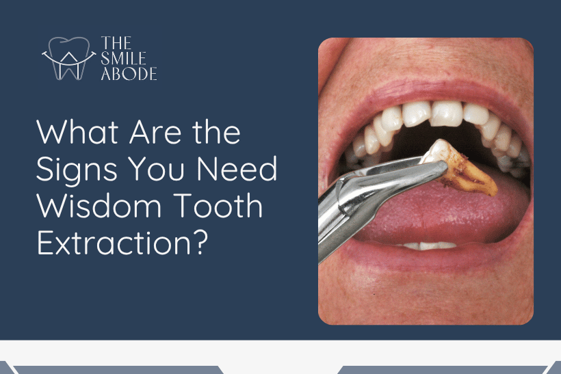 Best Wisdom Tooth Removal in Gurugram