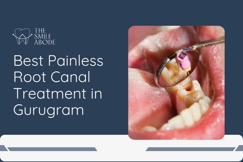 A dentist explaining root canal treatment in Gurugram using a dental X-ray